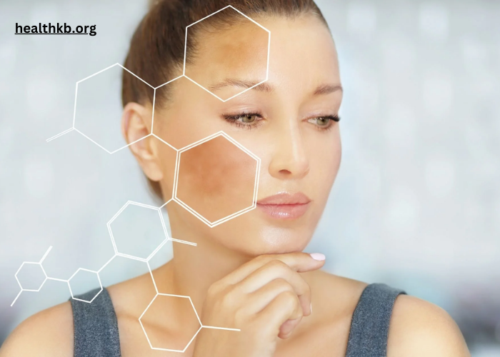 Understanding the Ways UV Rays Contribute to Melasma